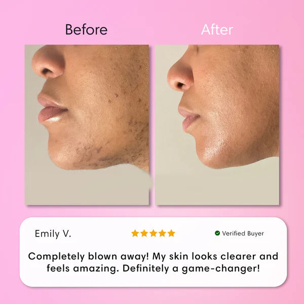 Hair Removal Kit