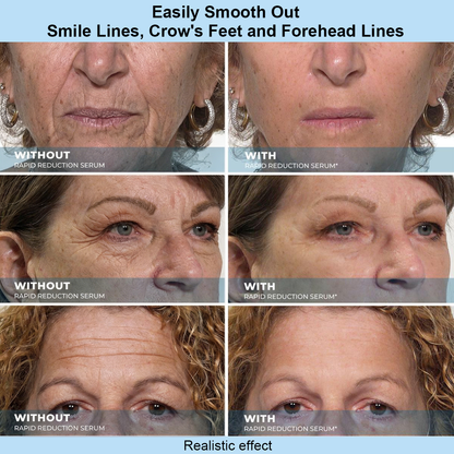 Viralaluna™ Instant Face Temporary Tightener – Instant visible results in 30 seconds