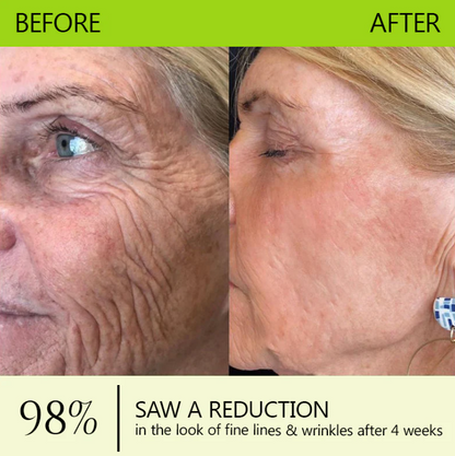 Botox & Retinol Shot - Eraser for Deep Wrinkles, Sagging Jowls & Puffy Eyes