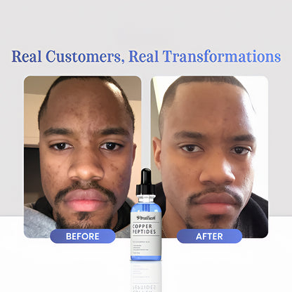 GHK-Cu Copper Peptides Serum