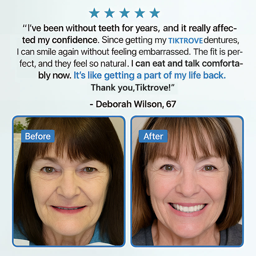 Viralaluna Adsorptive Denture