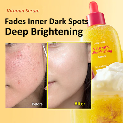 [#1 Solution for Dark Skin] Vitamin Illuminating Serum