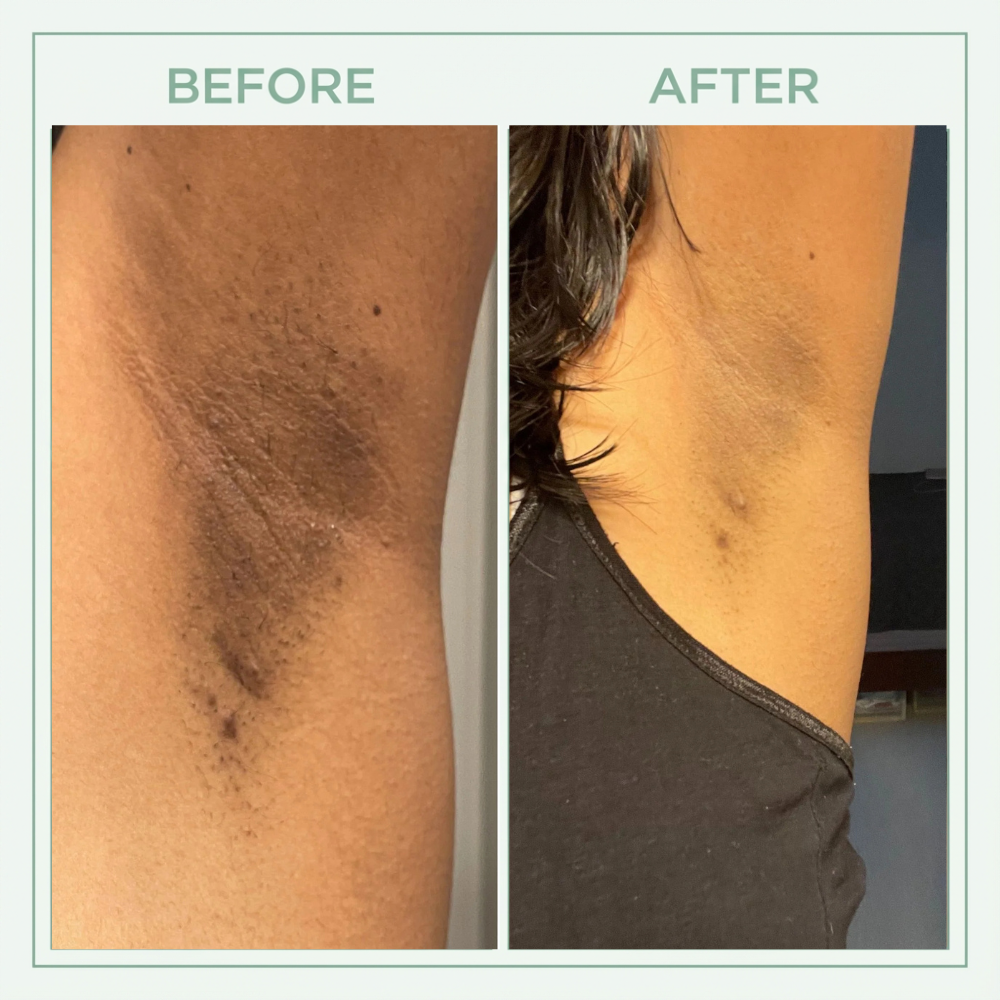Viralaluna™ Bright Peel Spray