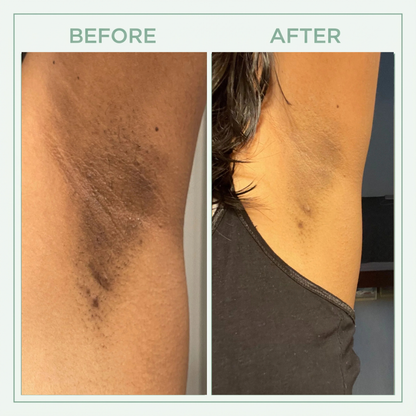 Viralaluna™ Bright Peel Spray