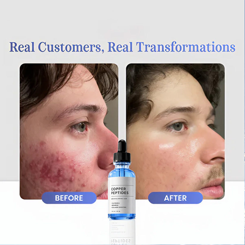 GHK-Cu Copper Peptides Serum