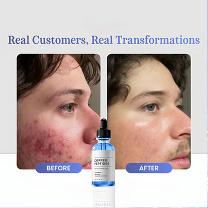 GHK-Cu Copper Peptides Serum