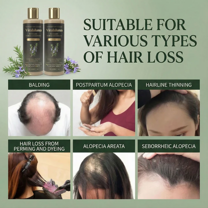 Viralaluna™ Growth-Support Shampoo - 2-Pack