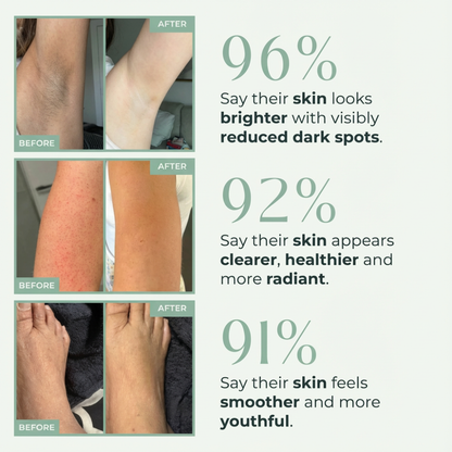 Viralaluna™ Bright Peel Spray