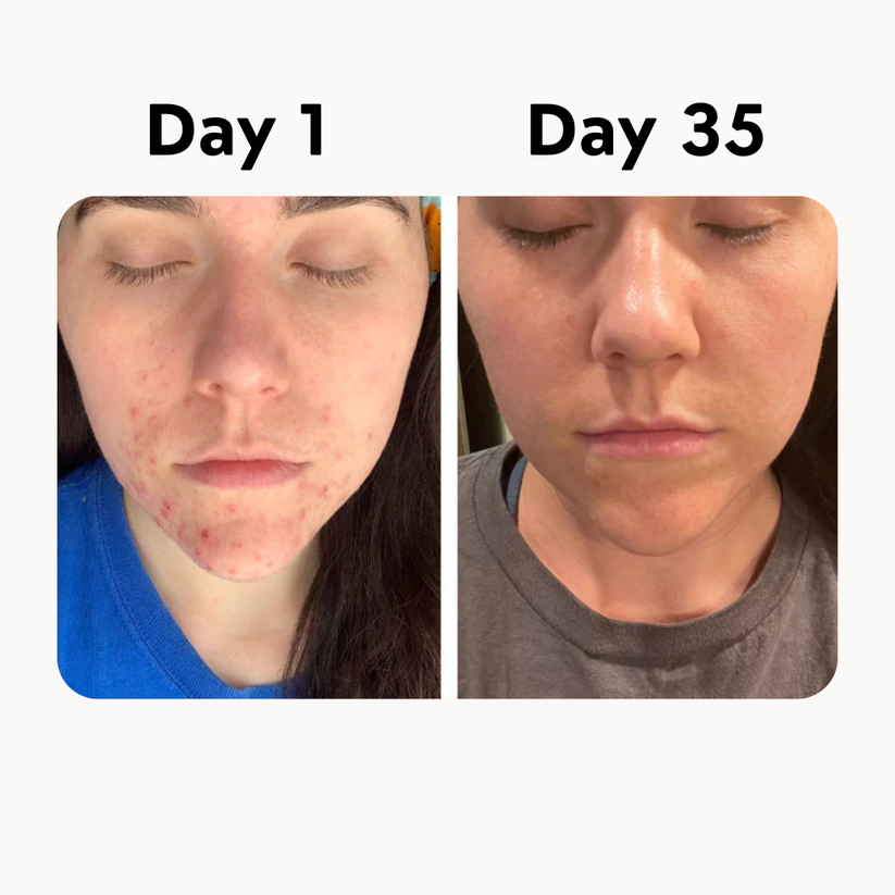 Organic Grass-Fed Beef Tallow Balm With Raw Honey