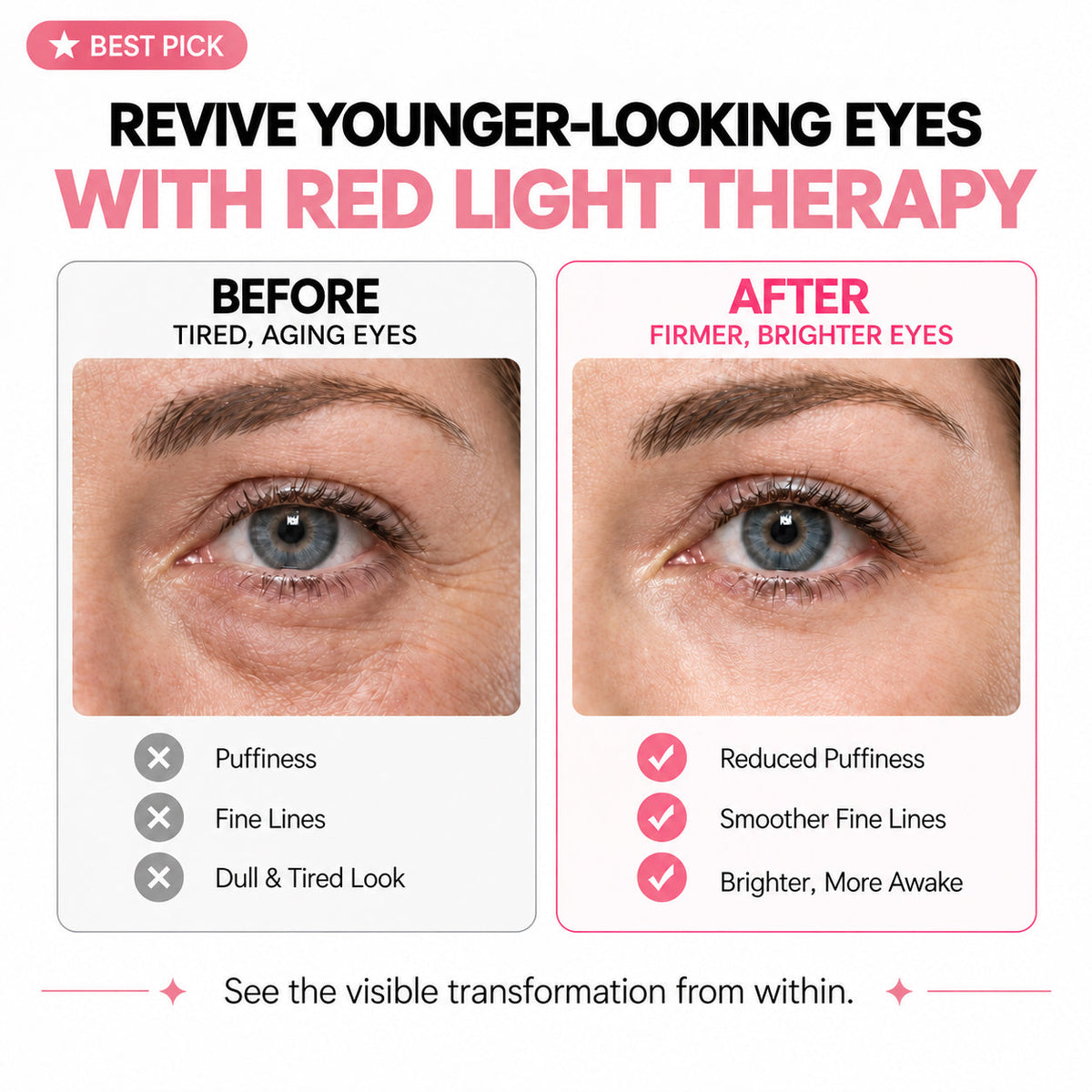 2-in-1 Red Light Therapy + EMS To Erase Eye Bags