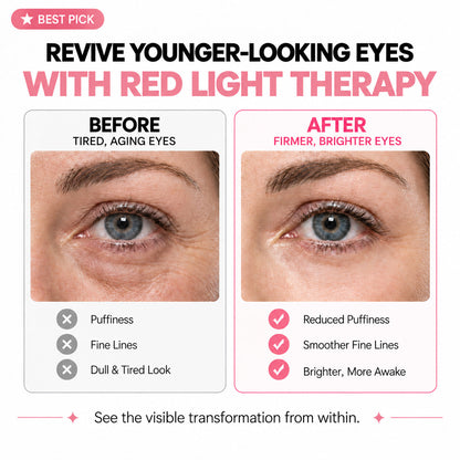 2-in-1 Red Light Therapy + EMS To Erase Eye Bags