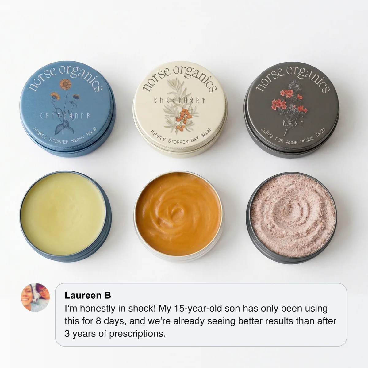 Kill Acne & Redness Ritual✨