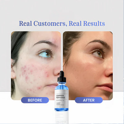 GHK-Cu Copper Peptides Serum
