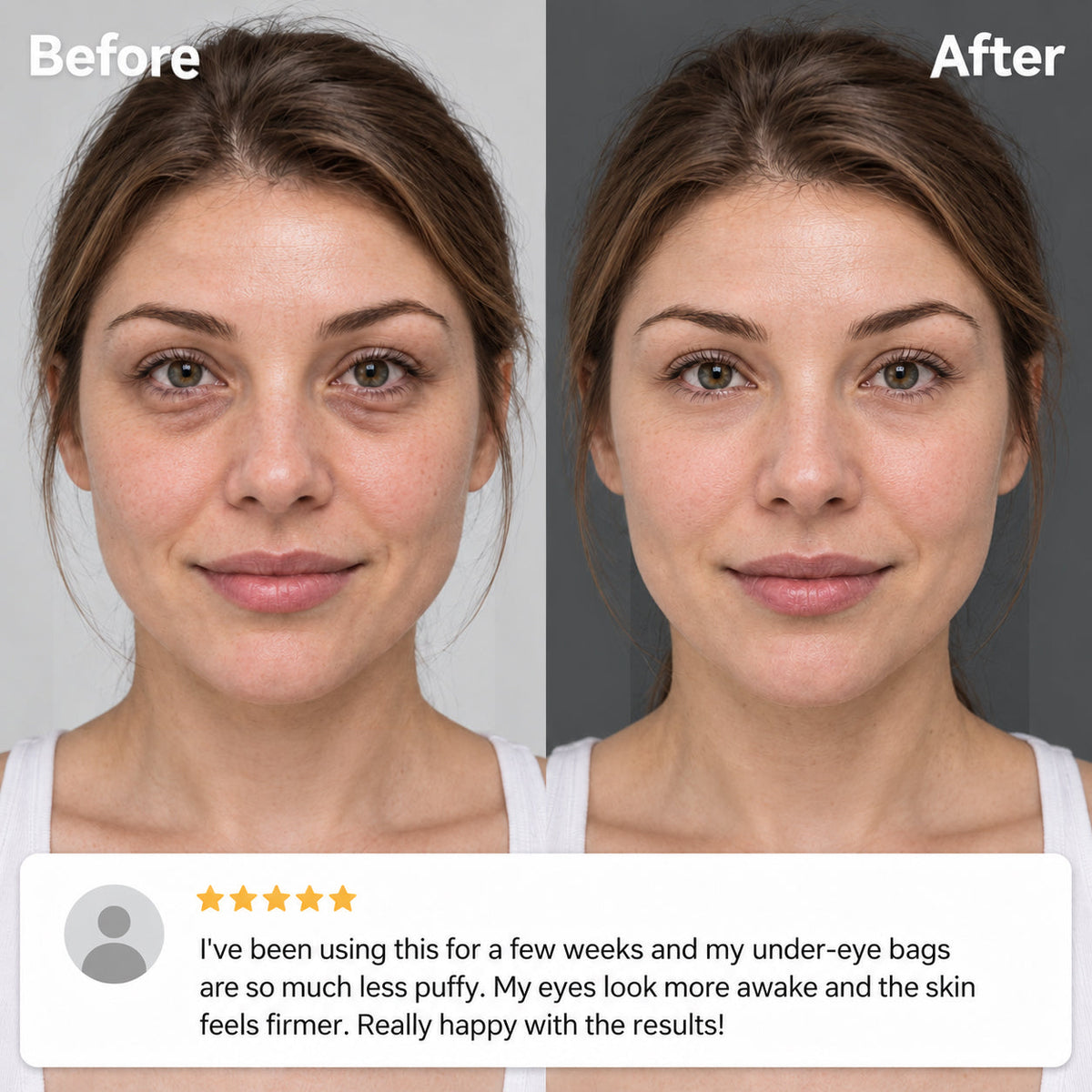 2-in-1 Red Light Therapy + EMS To Erase Eye Bags
