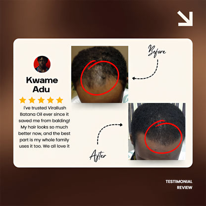 Batana Natural Hair Growth Oil 2.0