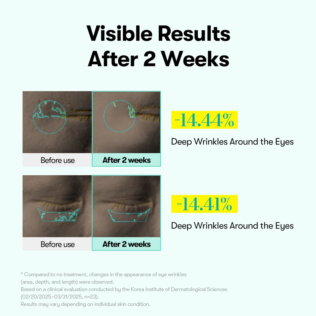 #1Viral PDRN Micro-Vibration Eye Applicator Cream