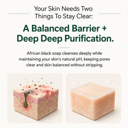 Pure Nilotica Shea Butter by Viralaluna™
