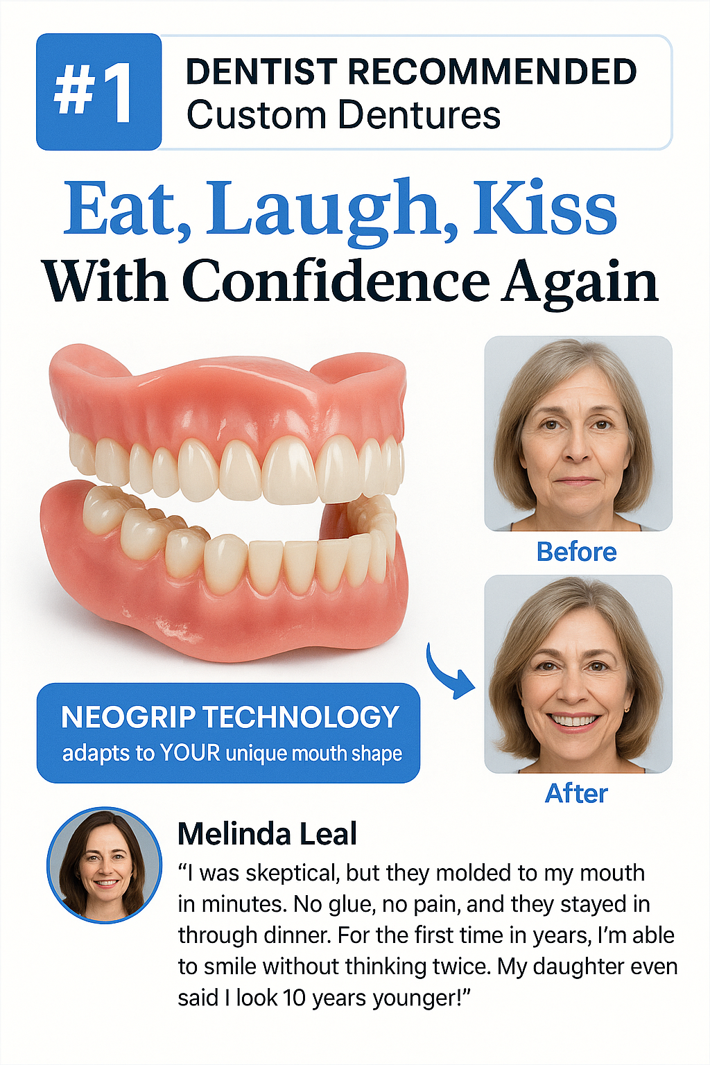 Viralaluna Adsorptive Denture