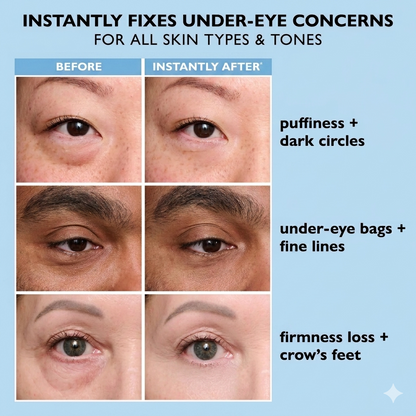 Viralaluna™ Instant Face Temporary Tightener – Instant visible results in 60 seconds