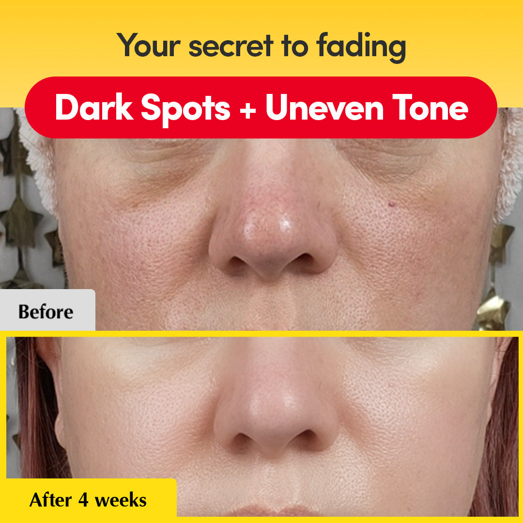 [#1 Solution for Dark Skin] Vitamin Illuminating Serum