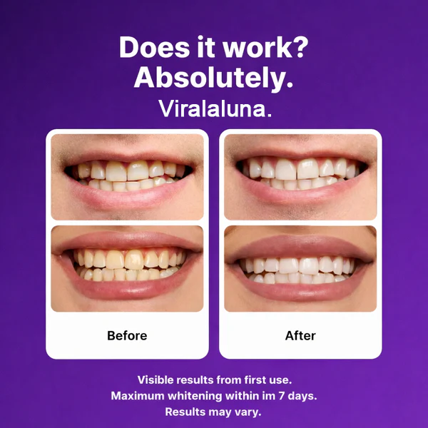 Viralaluna™ Color-Correct Whitening Strips