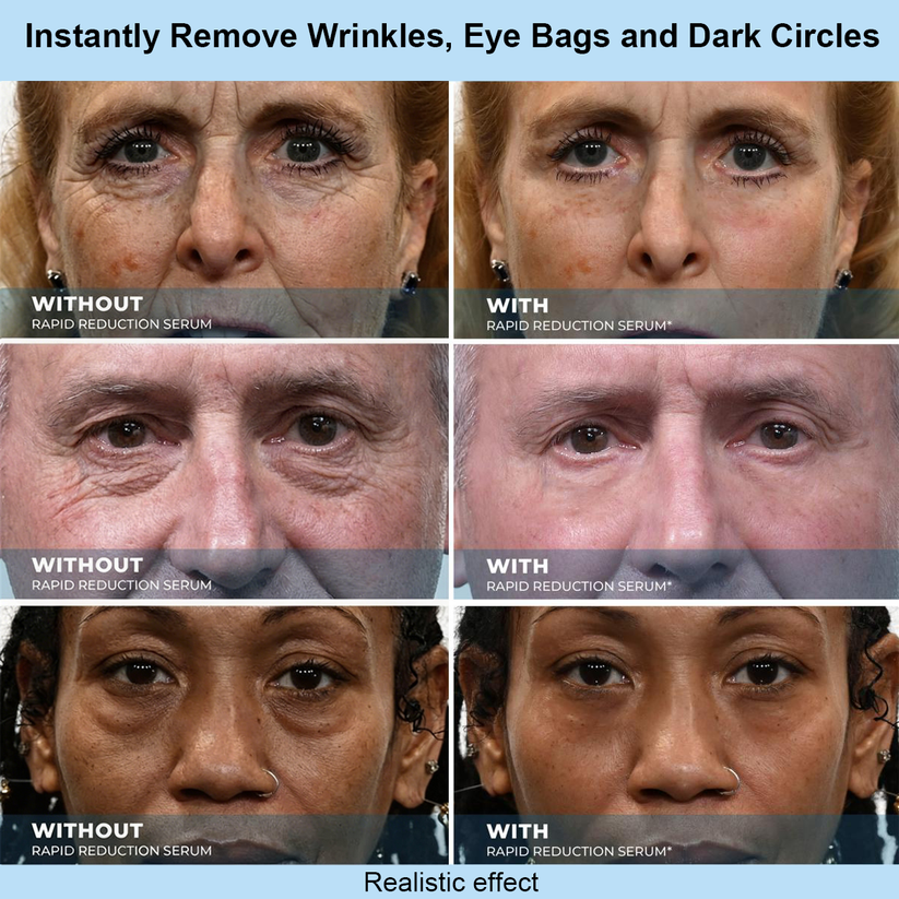 Viralaluna™ Instant Face Temporary Tightener – Instant visible results in 30 seconds