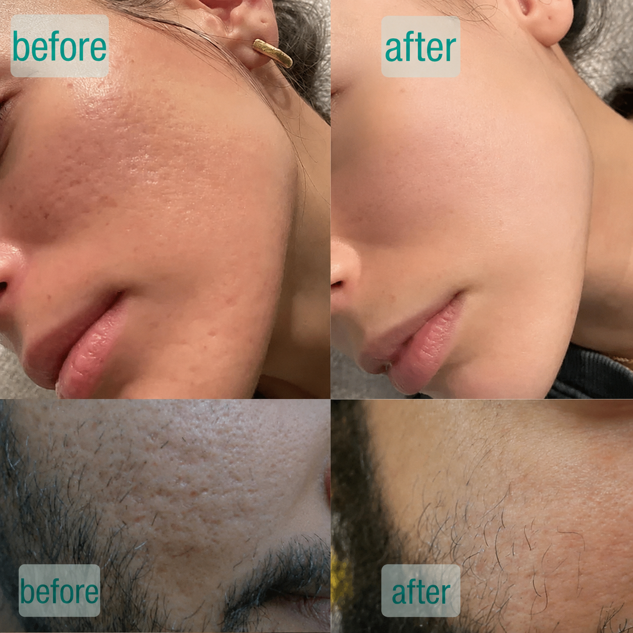 Microcrystal™ Serum PM Duo