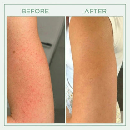 Viralaluna™ Bright Peel Spray