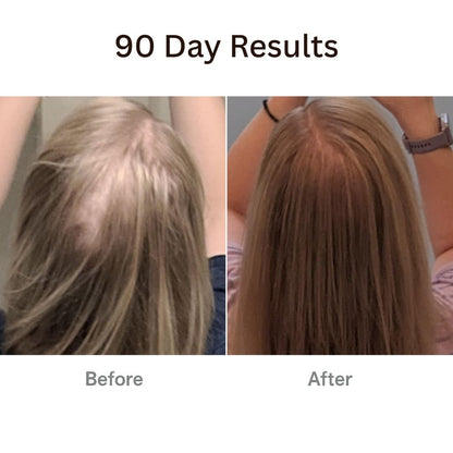 Viralaluna™ The Natural 4in1 Hair Restoring Brush