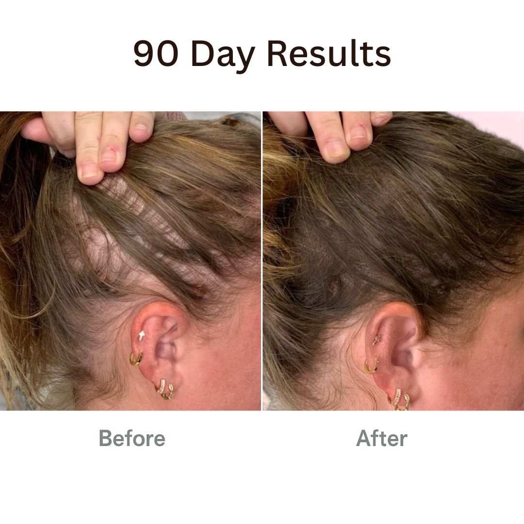 Viralaluna™ The Natural 4in1 Hair Restoring Brush