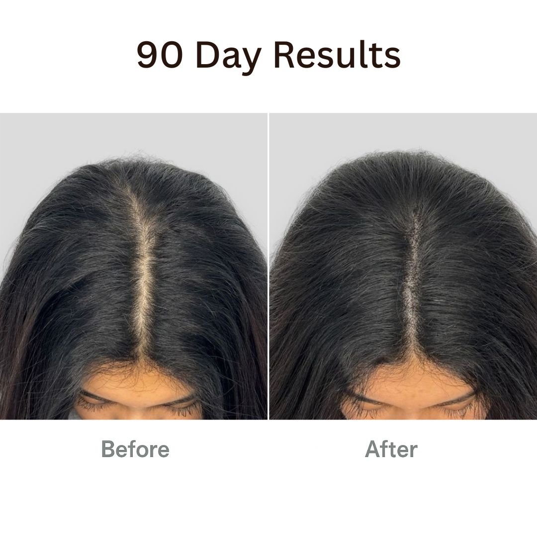 Viralaluna™ The Natural 4in1 Hair Restoring Brush