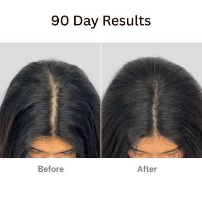Viralaluna™ The Natural 4in1 Hair Restoring Brush
