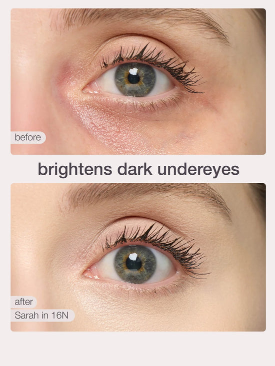 Before and after - brightens dark undereyes
